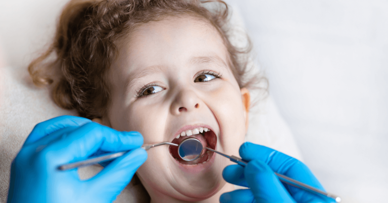Causes and Precautions of Toothcaries in Children