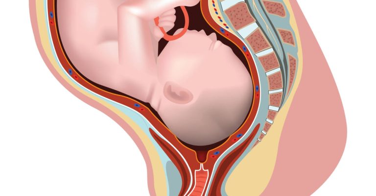What Does Cervical Opening Mean in the Delivery Process?