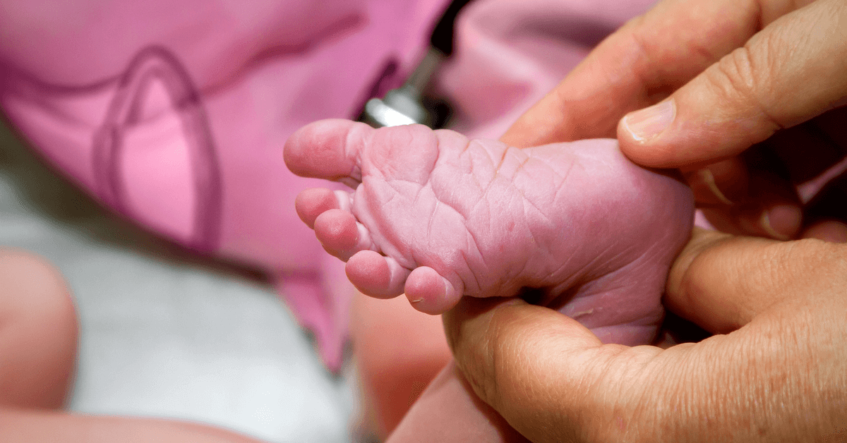 Babinski Reflex in 3 Questions