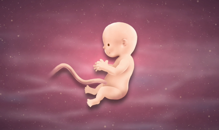 10 Weeks Pregnant