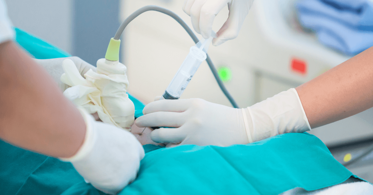 Paternity Test During Pregnancy